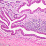 B26, Rectal-Anal Junction, 10x (H&E)