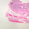B26, Rectal-Anal Junction, 2.5x (H&E)