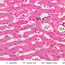B29, Liver (Sinusoids), 40x Labeled (H&E)