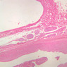 A28, Renal Vein, 2.5x (H&E)