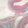A28, Renal Vein, 2.5x (AF)