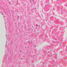 A28, Renal Vein, 20x (H&E)