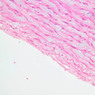 Cardiovascular
