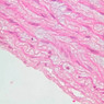 Cardiovascular
