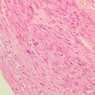 Cardiovascular