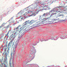 Cardiovascular
