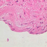 Cardiovascular