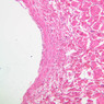 Cardiovascular