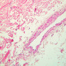 Cardiovascular