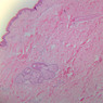 Cardiovascular