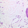 Cardiovascular