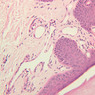 Cardiovascular