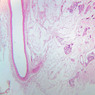 Cardiovascular