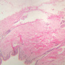 Cardiovascular