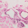 Cardiovascular