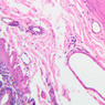 Cardiovascular