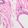 Cardiovascular