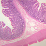 Cardiovascular