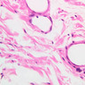 Cardiovascular