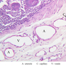 Cardiovascular