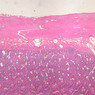 Cardiovascular