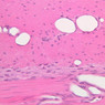 Cardiovascular