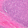Cardiovascular