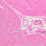 Cardiovascular