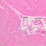 Cardiovascular