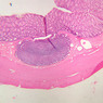 Cardiovascular