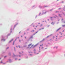 Cardiovascular