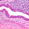Cardiovascular