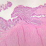 Cardiovascular