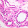 Cardiovascular