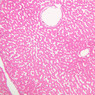 Cardiovascular