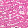 Cardiovascular