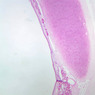 A72, Trachea, 2.5x (PAS)