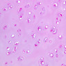 A72, Trachea, 20x (PAS)