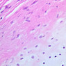 A76, Trachea, 40x (H&E)