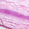 A51, Ear (Cartilage), 10x (H&E)
