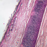 A51, Ear (Cartilage), 2.5x (Verhoeff)