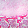 A3, Intervertebral Disk, 2.5x (H&E)