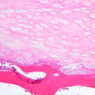 A3, Intervertebral Disk, 10x (H&E)