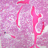 A3, Intervertebral Disk, 2.5x (H&E)