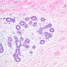 A93, Mammary, 10x (H&E)