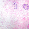 A93, Mammary, 2.5x (H&E)
