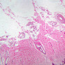 A58, Axilla, 2.5x (H&E)