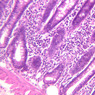 B12, Jejunum, 20x (H&E)