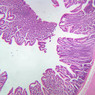 B12, Jejunum, 2.5x (H&E)