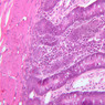 B15, Jejunum, 20x (H&E)
